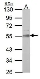 Anti-AAMP antibody used in Western Blot (WB). GTX119410