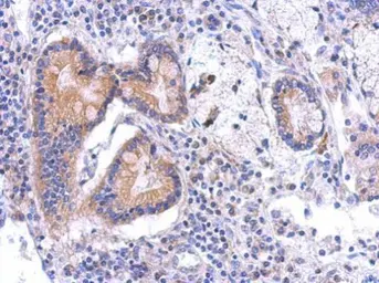 Anti-BCKDK antibody [N1C2] used in IHC (Paraffin sections) (IHC-P). GTX119413