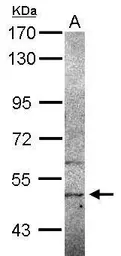 Anti-SIGLEC12 antibody [N2C2], Internal used in Western Blot (WB). GTX119418
