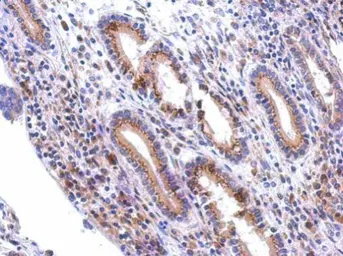 Anti-GALNT7 antibody [C1C3] used in IHC (Paraffin sections) (IHC-P). GTX119421