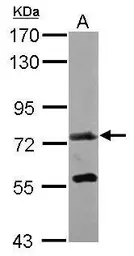 Anti-GALNT7 antibody [C1C3] used in Western Blot (WB). GTX119421