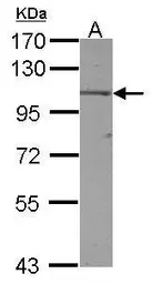 Anti-TRAK2 antibody [N1N2], N-term used in Western Blot (WB). GTX119423