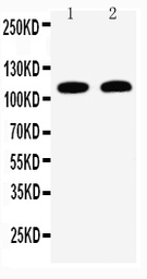 Anti-Desmoglein 3 antibody used in Western Blot (WB). GTX11943