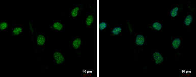 Anti-PASD1 antibody used in Immunocytochemistry/ Immunofluorescence (ICC/IF). GTX119431