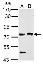 Anti-PASD1 antibody used in Western Blot (WB). GTX119431