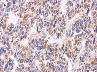 Anti-KIR2DS2 antibody used in IHC (Paraffin sections) (IHC-P). GTX119432