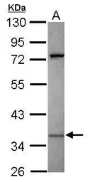 Anti-KIR2DS2 antibody used in Western Blot (WB). GTX119432