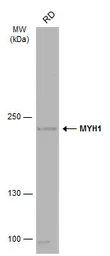 Anti-MYH1 antibody [N1], N-term used in Western Blot (WB). GTX119435