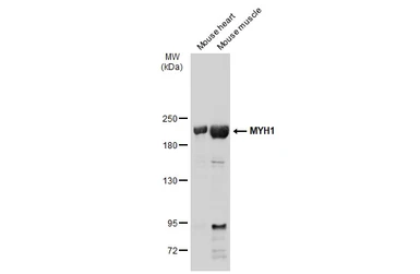 Anti-MYH1 antibody [N1], N-term used in Western Blot (WB). GTX119435