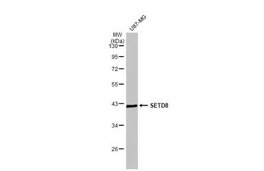 Anti-SETD8 antibody used in Western Blot (WB). GTX119440