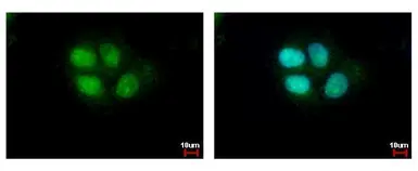 Anti-SETD8 antibody used in Immunocytochemistry/ Immunofluorescence (ICC/IF). GTX119440