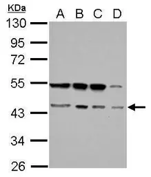 Anti-RBM22 antibody used in Western Blot (WB). GTX119443