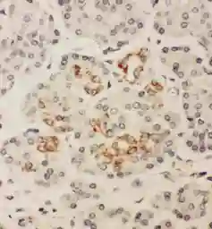 Anti-HOXA3 antibody used in IHC (Paraffin sections) (IHC-P). GTX11945