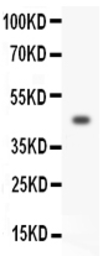 Anti-HOXA3 antibody used in Western Blot (WB). GTX11945
