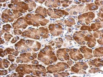 Anti-SARS2 antibody [N3C2], Internal used in IHC (Paraffin sections) (IHC-P). GTX119451