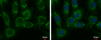 Anti-SARS2 antibody [N1C1] used in Immunocytochemistry/ Immunofluorescence (ICC/IF). GTX119452