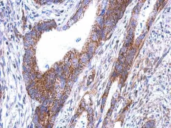 Anti-SARS2 antibody [N1C1] used in IHC (Paraffin sections) (IHC-P). GTX119452