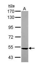 Anti-SARS2 antibody [N1C1] used in Western Blot (WB). GTX119452