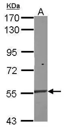Anti-NAC1 antibody used in Western Blot (WB). GTX119455