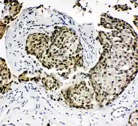 Anti-HOXA4 antibody used in IHC (Paraffin sections) (IHC-P). GTX11946