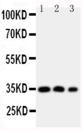 Anti-HOXA4 antibody used in Western Blot (WB). GTX11946