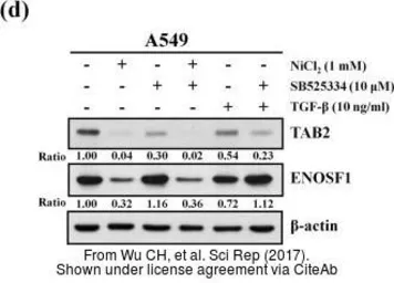 Anti-ENOSF1 antibody [N1C2] used in Western Blot (WB). GTX119464