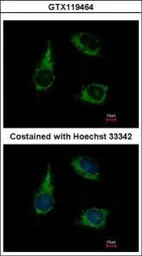 Anti-ENOSF1 antibody [N1C2] used in Immunocytochemistry/ Immunofluorescence (ICC/IF). GTX119464