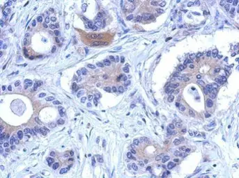 Anti-ENOSF1 antibody [N1C2] used in IHC (Paraffin sections) (IHC-P). GTX119464