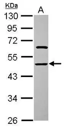 Anti-ENOSF1 antibody [N1C2] used in Western Blot (WB). GTX119464