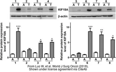 Anti-KIF18A antibody [N1N2], N-term used in Western Blot (WB). GTX119467