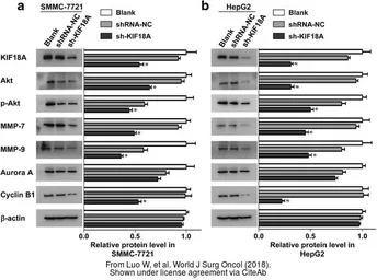 Anti-KIF18A antibody [N1N2], N-term used in Western Blot (WB). GTX119467