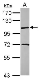 Anti-KIF18A antibody [N1N2], N-term used in Western Blot (WB). GTX119467