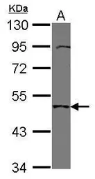 Anti-TMPRSS11B antibody [N1C1] used in Western Blot (WB). GTX119482