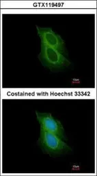 Anti-Spinesin antibody [N3C3] used in Immunocytochemistry/ Immunofluorescence (ICC/IF). GTX119497