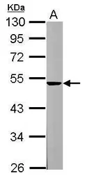 Anti-Spinesin antibody [N3C3] used in Western Blot (WB). GTX119497