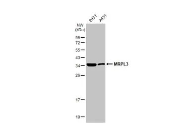 Anti-MRPL3 antibody [N3C3] used in Western Blot (WB). GTX119503