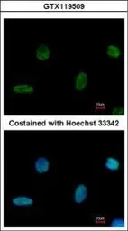 Anti-PGBD1 antibody [N1N3] used in Immunocytochemistry/ Immunofluorescence (ICC/IF). GTX119509