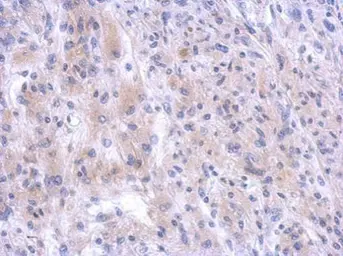 Anti-PGBD1 antibody [N1N3] used in IHC (Paraffin sections) (IHC-P). GTX119509