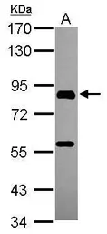Anti-PGBD1 antibody [N1N3] used in Western Blot (WB). GTX119509