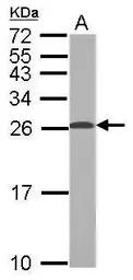 Anti-TPPP antibody [N1C3] used in Western Blot (WB). GTX119520
