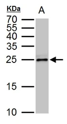 Anti-TPPP antibody [N1C3] used in Western Blot (WB). GTX119520