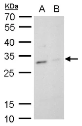 Anti-TPPP antibody [N1C3] used in Western Blot (WB). GTX119520