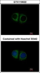 Anti-MRPS10 antibody [N1C3] used in Immunocytochemistry/ Immunofluorescence (ICC/IF). GTX119522