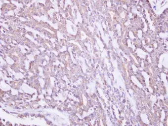 Anti-MRPS10 antibody [N1C3] used in IHC (Paraffin sections) (IHC-P). GTX119522