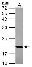 Anti-MRPS10 antibody [N1C3] used in Western Blot (WB). GTX119522