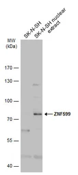 Anti-ZNF599 antibody used in Western Blot (WB). GTX119526