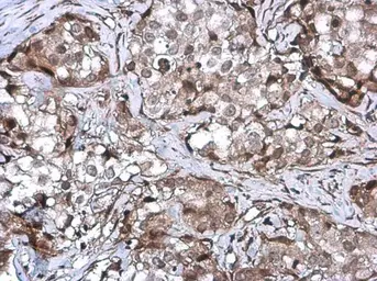 Anti-ZNF599 antibody used in IHC (Paraffin sections) (IHC-P). GTX119526