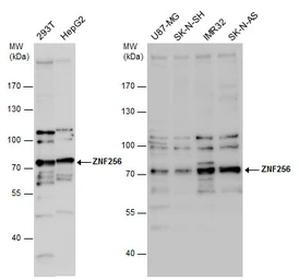 Anti-ZNF256 antibody [N1N3] used in Western Blot (WB). GTX119533