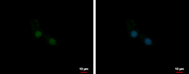 Anti-U1SNRNPBP antibody [N2C3] used in Immunocytochemistry/ Immunofluorescence (ICC/IF). GTX119546