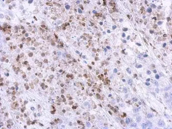 Anti-U1SNRNPBP antibody [N2C3] used in IHC (Paraffin sections) (IHC-P). GTX119546